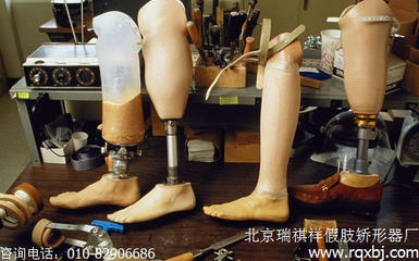 小腿假肢接受腔的選擇與種類 假肢與矯形器指南